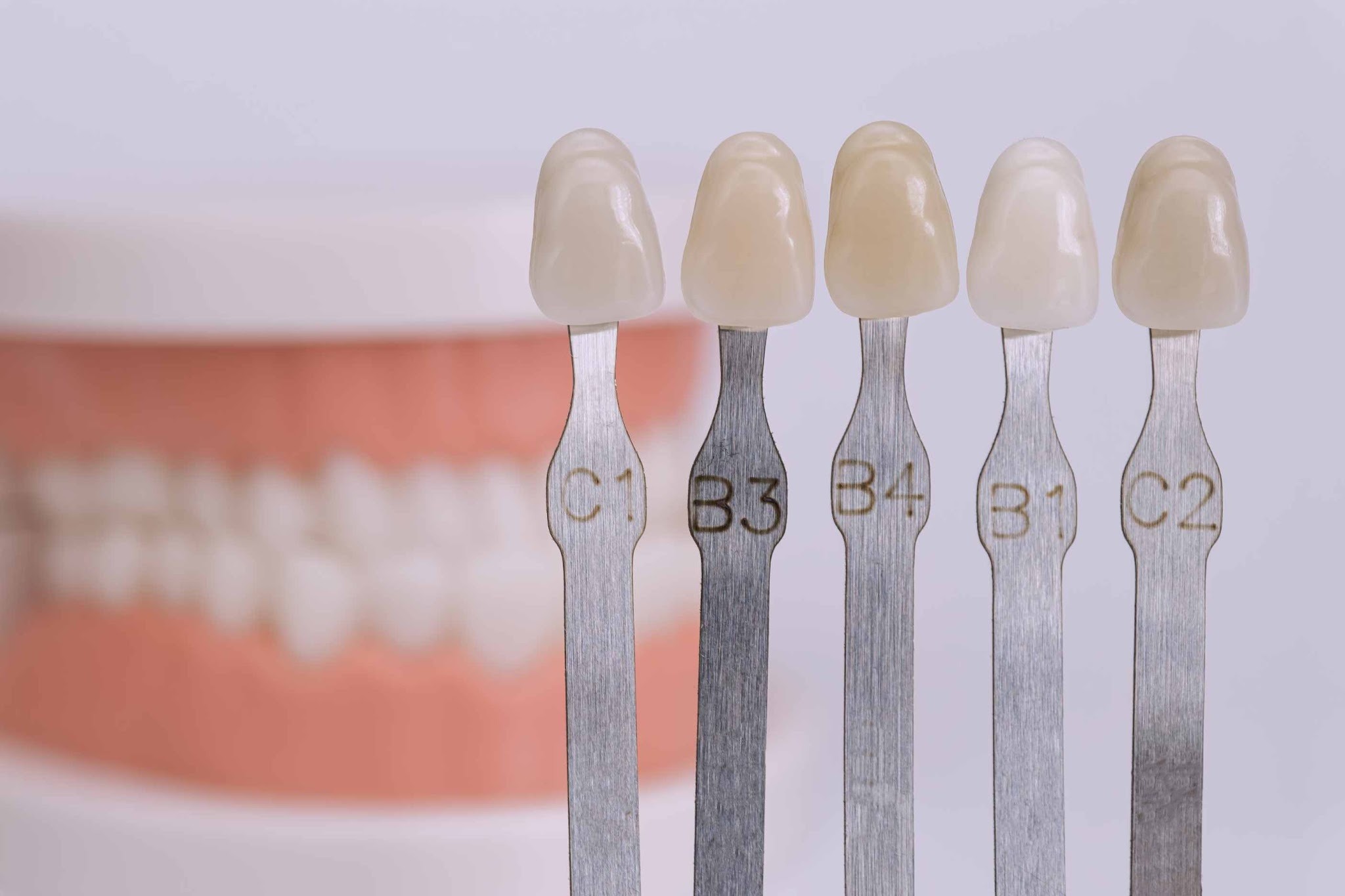 Composite bonding shade matching using dental colour guide in Purley