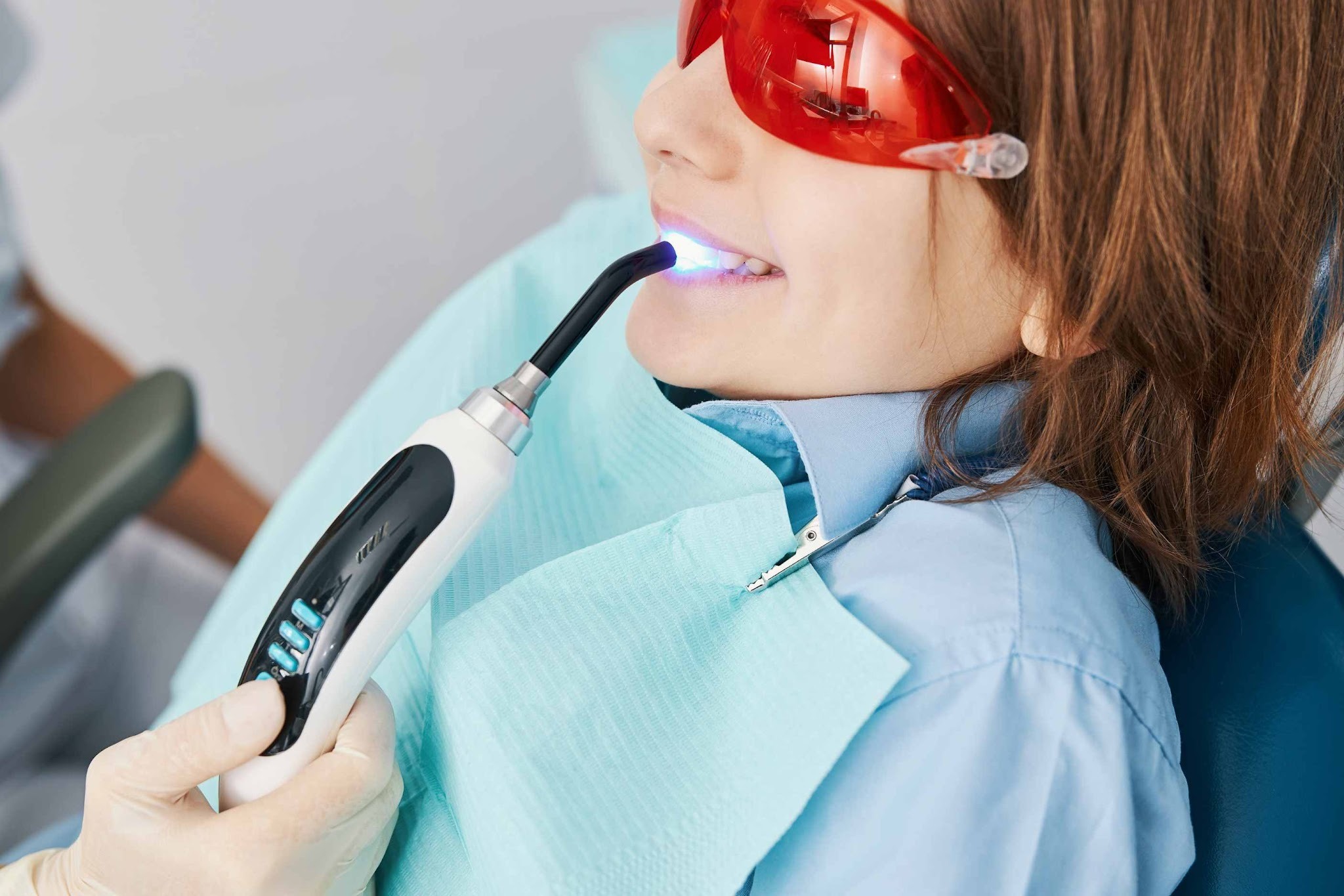 Composite bonding treatment using curing light to harden tooth-coloured composite resin