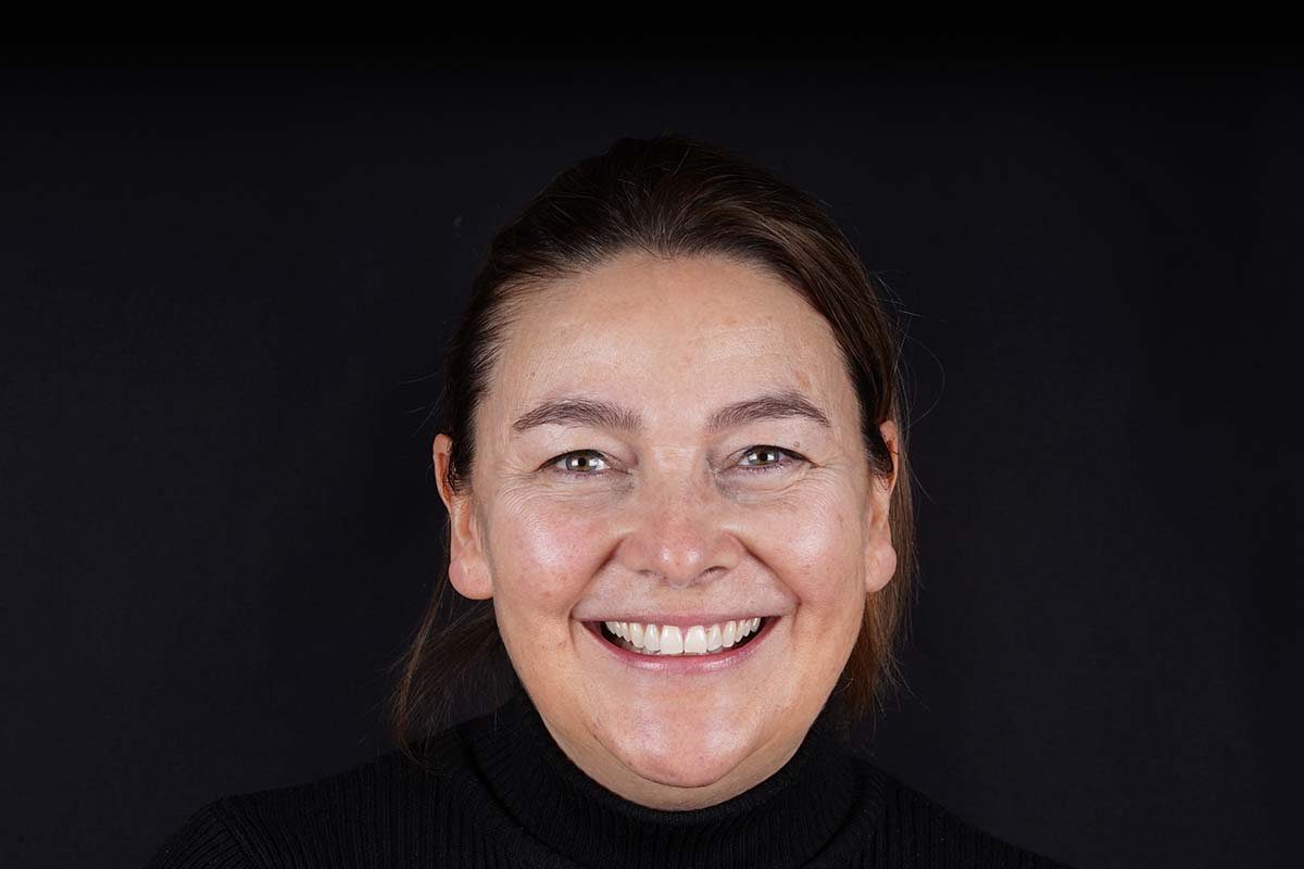 Smiling female patient at Foxley Lane Dental in Purley after receiving a full smile makeover. Her teeth appear straight, even, and natural-looking, with a confident smile that highlights the long-lasting results of cosmetic dentistry.