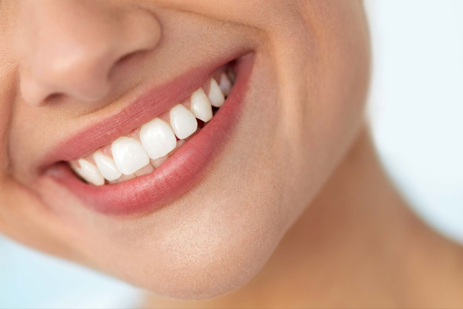 Close-up of a confident female smile with straight, white teeth as a result of complete smile makeovers with composite bonding treatment at Foxley Lane Dental in Purley.