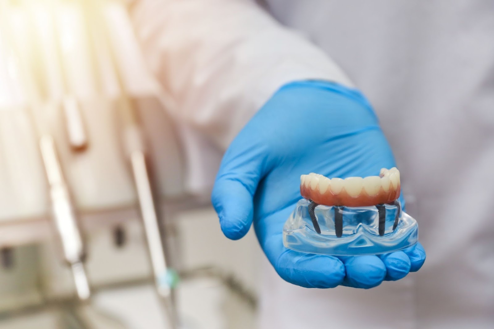 All-on-4 dental implant model held by implant dentist at Foxley Lane Dental in Purley