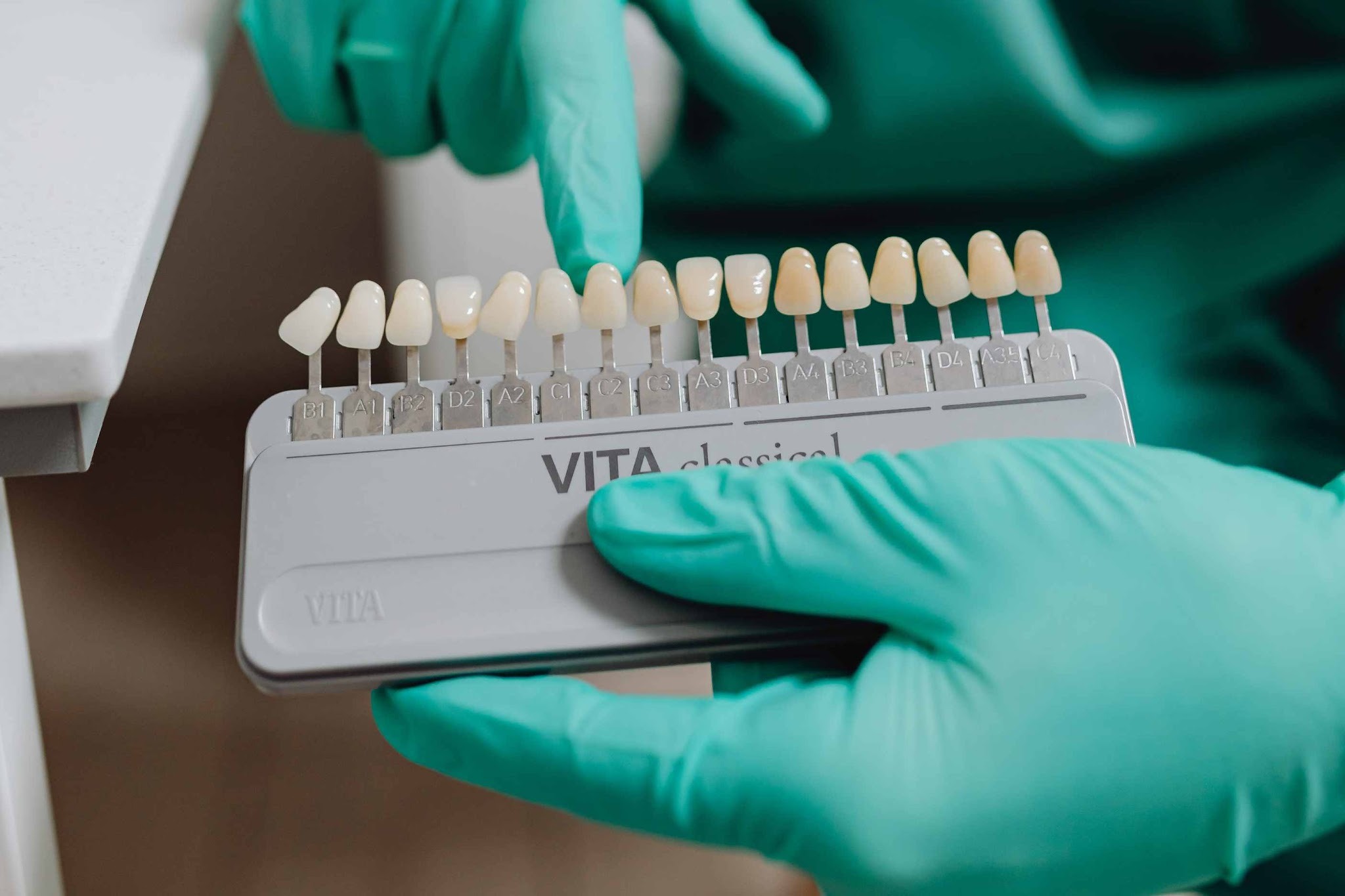 Shade matching for porcelain veneers using Vita colour guide at cosmetic dentist Purley
