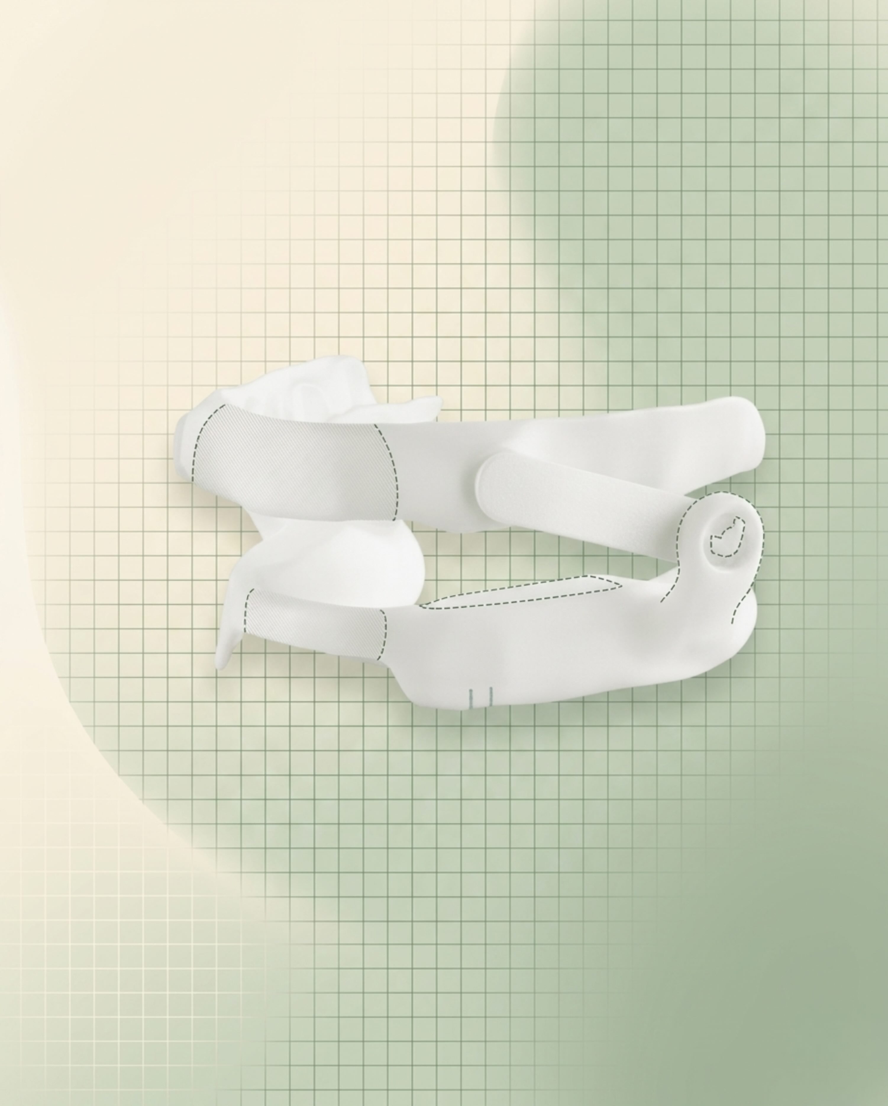 Aerox mandibular advancement device for sleep apnoea treatment in Purley