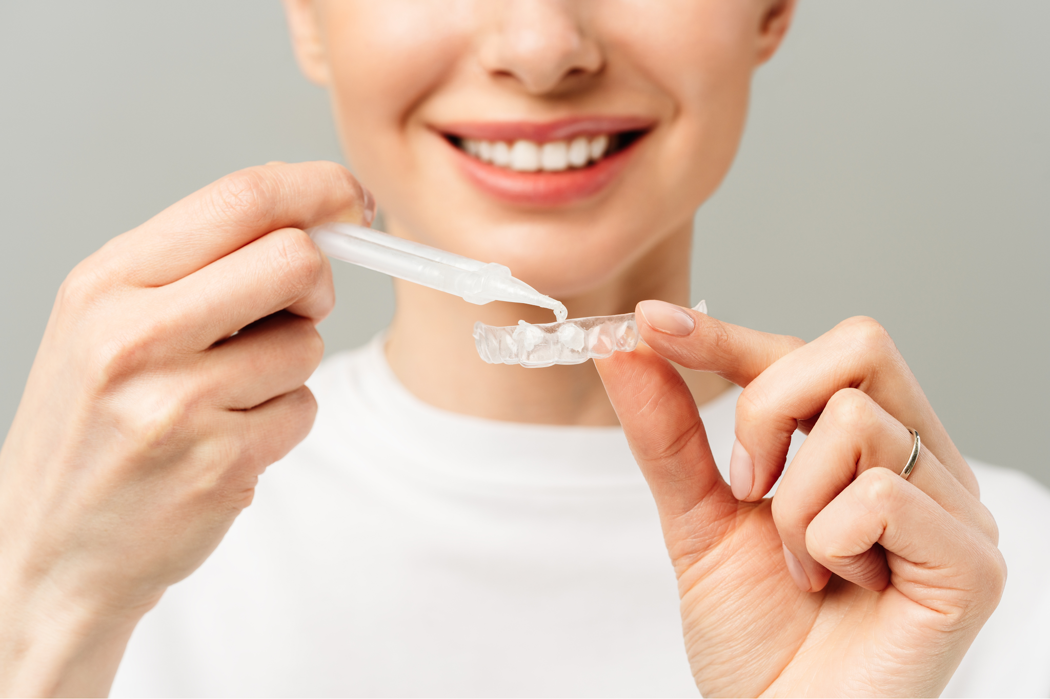 Professional teeth whitening trays with whitening gel for at-home teeth whitening treatment in Purley