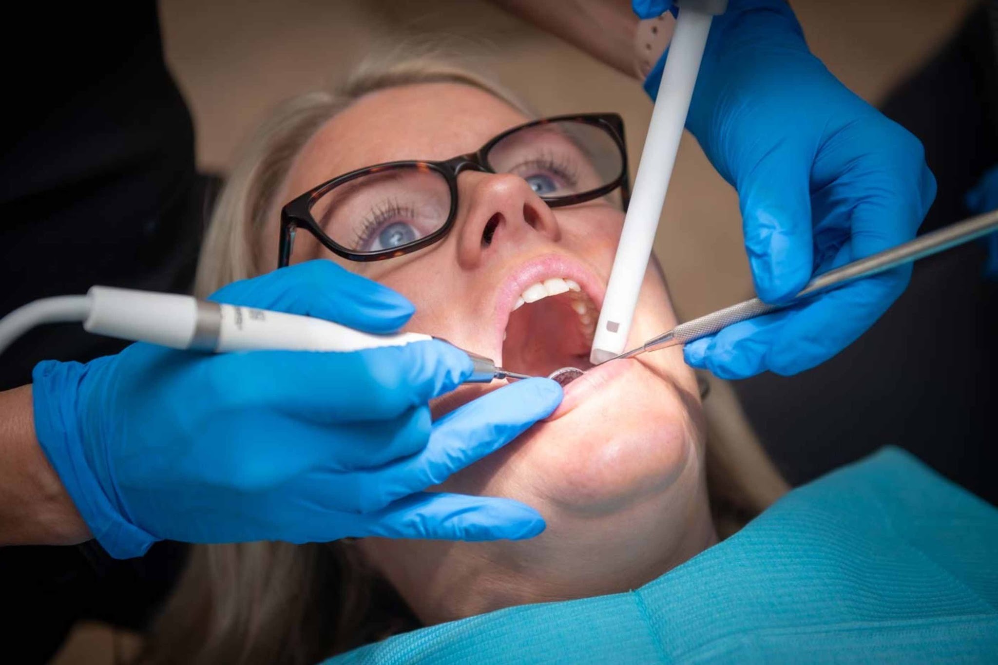 Dental polishing and maintenance appointment for composite bonding treatment in Purley