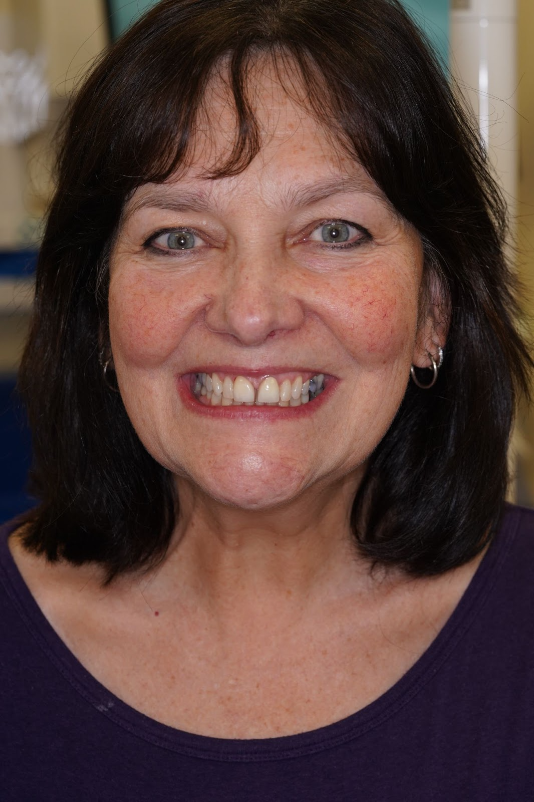 Happy patient smiling confidently after dental treatment at Foxley Lane Dental in Purley. Her natural-looking smile shows how personalised dental care and treatments can restore both teeth and confidence for patients.